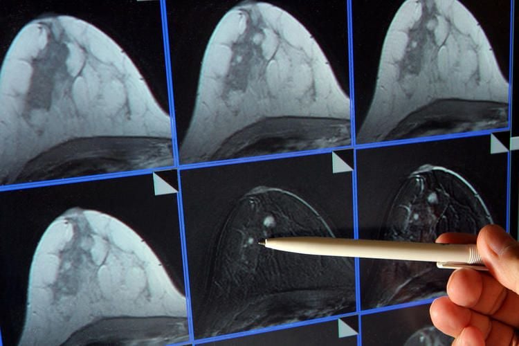 Image with id: DE474suXIgF8